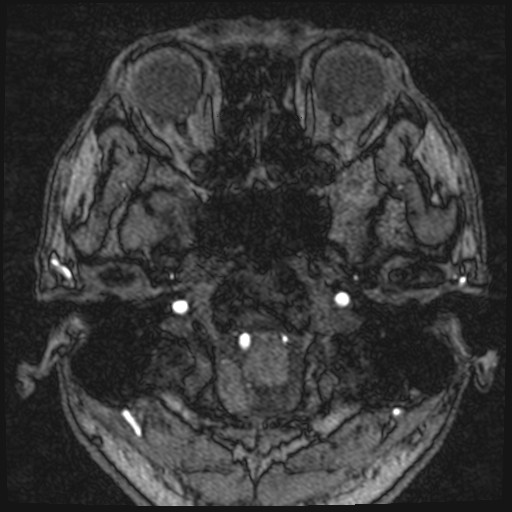 Click on the Serie image to view the images of VILLANUEVA, WILLIAM A.